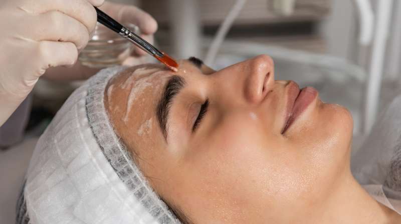 Are Chemical Peels Safe for Your Skin?